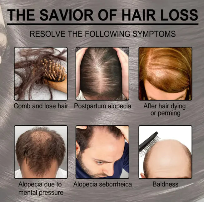 Aceite Esencial de Cuidado del Cabello con Romero Anti-caída