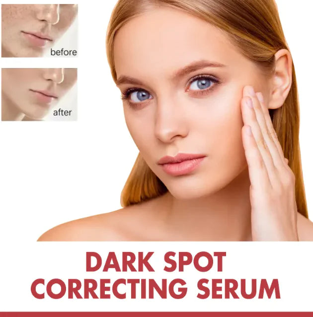 Solución Hidratante para Desvanecer Manchas en la Piel